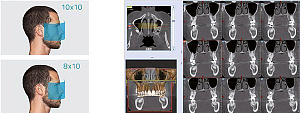 Стоматологический томограф NewTom 2D/3D GO (10x10) - Фото 9